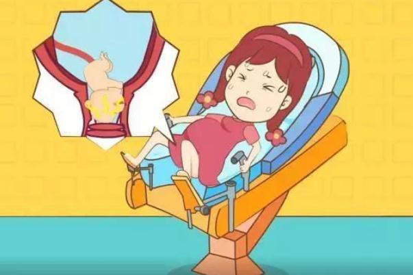 順產(chǎn)和剖腹產(chǎn)哪個(gè)對(duì)女人好 順產(chǎn)撕裂縫針多久恢復(fù) 順產(chǎn)和剖腹產(chǎn)哪個(gè)對(duì)女人好 順產(chǎn)撕裂縫針多久恢復(fù)