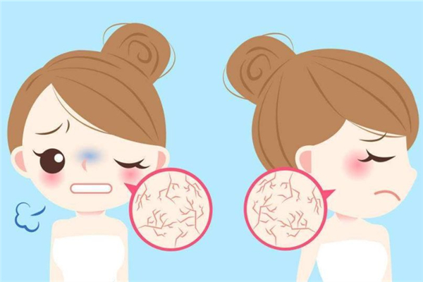 皮膚干燥的原因是什么 皮膚干燥會(huì)引起什么皮膚問題 皮膚干燥的原因是什么 皮膚干燥會(huì)引起什么皮膚問題