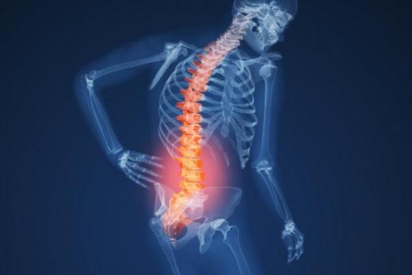 腰痛怎么辦快速緩解疼痛 腰痛掛什么科 腰痛怎么辦快速緩解疼痛 腰痛掛什么科