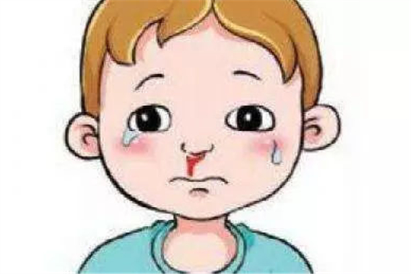 流鼻血有血塊是什么原因引起的 流鼻血會導(dǎo)致貧血嗎 流鼻血有血塊是什么原因引起的 流鼻血會導(dǎo)致貧血嗎