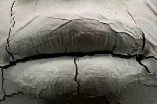 唇炎怎么快速治好 導致患上唇炎的因素 唇炎怎么快速治好 導致患上唇炎的因素