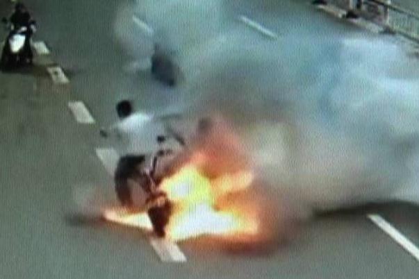 電瓶車行駛中爆燃 燒傷女孩病危 電瓶車行駛中爆燃 燒傷女孩病危