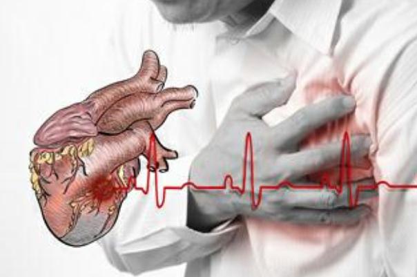 心臟病是遺傳病嗎 心臟病是慢性疾病嗎 心臟病是遺傳病嗎 心臟病是慢性疾病嗎