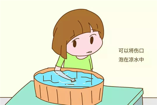 燙傷之后用冰敷可以嗎 燙傷后冰敷多久合適 燙傷之后用冰敷可以嗎 燙傷后冰敷多久合適