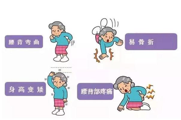 骨質(zhì)疏松有哪些癥狀表現(xiàn) 骨質(zhì)疏松怎么治才能徹底治好 骨質(zhì)疏松有哪些癥狀表現(xiàn) 骨質(zhì)疏松怎么治才能徹底治好