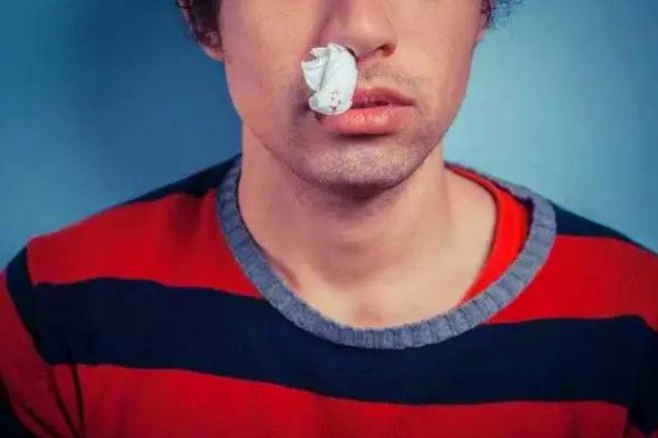 流鼻血吃什么食物好 流鼻血的好處 流鼻血吃什么食物好 流鼻血的好處