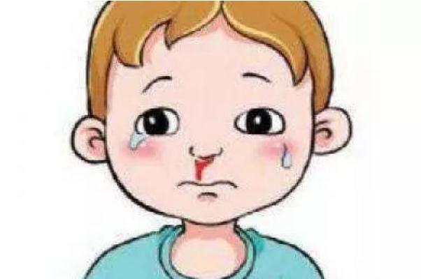 流鼻血是癌癥的前兆嗎 流鼻血是白血病的前兆嗎 流鼻血是癌癥的前兆嗎 流鼻血是白血病的前兆嗎