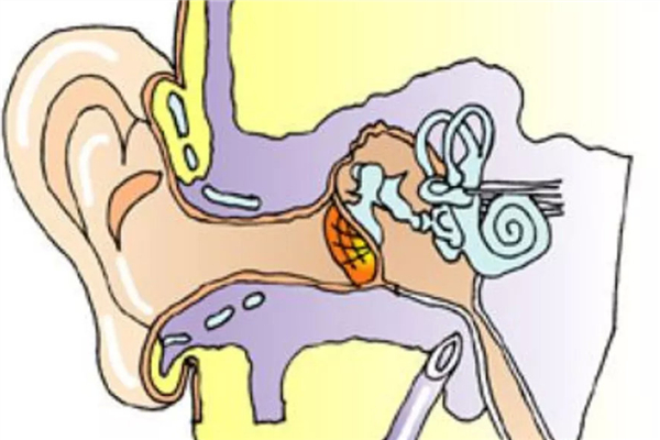 中耳炎流膿怎么辦 中耳炎流膿發(fā)臭嚴(yán)重嗎 中耳炎流膿怎么辦 中耳炎流膿發(fā)臭嚴(yán)重嗎