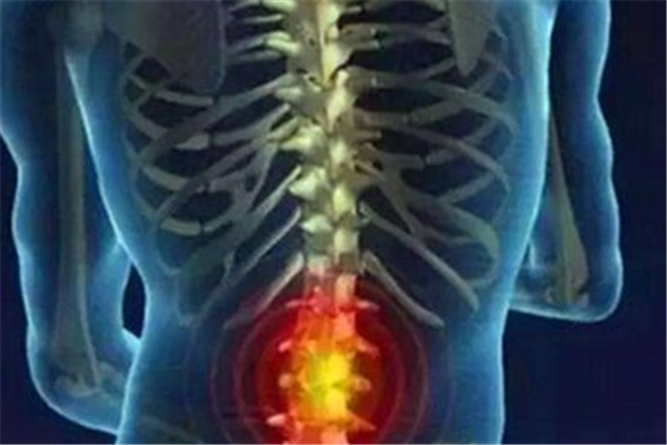 骨質(zhì)增生會(huì)痛嗎 骨質(zhì)增生能熱敷嗎 骨質(zhì)增生會(huì)痛嗎 骨質(zhì)增生能熱敷嗎