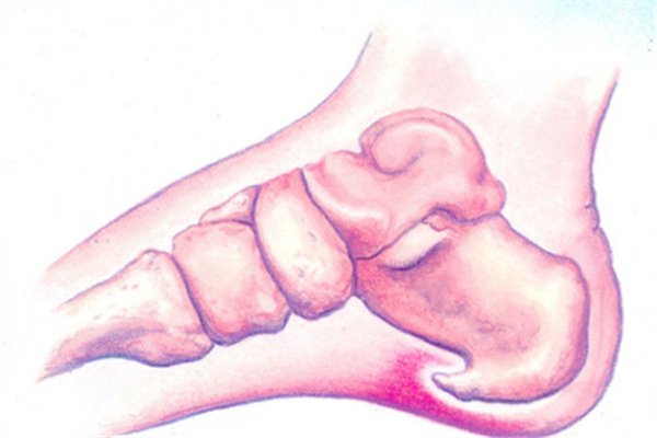 骨質(zhì)增生可以針灸嗎 骨質(zhì)增生用什么方法治療好 骨質(zhì)增生可以針灸嗎 骨質(zhì)增生用什么方法治療好