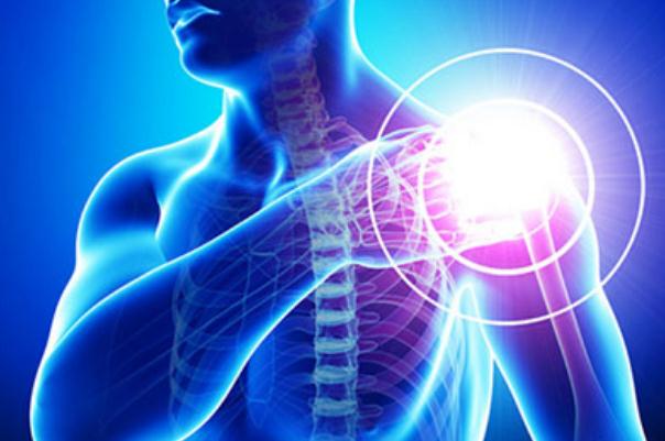 肩周炎是哪個(gè)部位痛 肩周炎是幾級疼痛 肩周炎是哪個(gè)部位痛 肩周炎是幾級疼痛