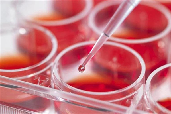 蝦青素對黃褐斑有用嗎 蝦青素可以祛斑嗎 蝦青素對黃褐斑有用嗎 蝦青素可以祛斑嗎