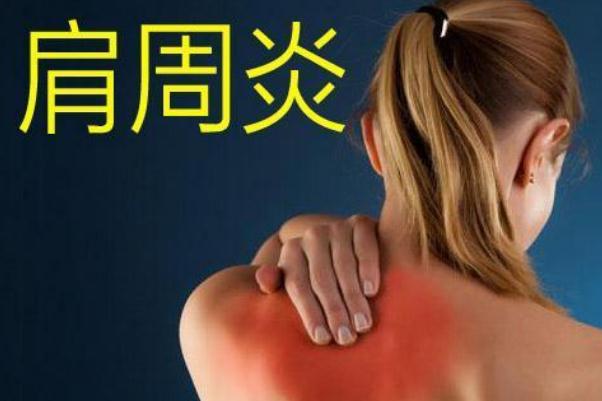 肩周炎怎么治療最快最好方法 肩周炎的癥狀表現(xiàn) 肩周炎怎么治療最快最好方法 肩周炎的癥狀表現(xiàn)