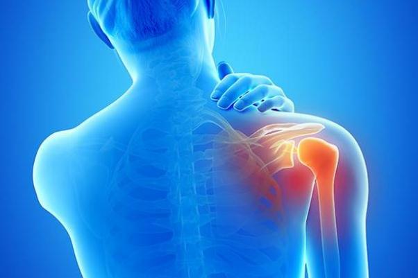 肩周炎怎么治療最快最好方法 肩周炎的癥狀表現(xiàn) 肩周炎怎么治療最快最好方法 肩周炎的癥狀表現(xiàn)