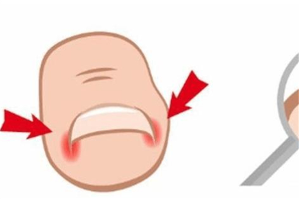 甲溝炎去醫(yī)院掛什么科 甲溝炎去醫(yī)院還是去修腳的地方 甲溝炎去醫(yī)院掛什么科 甲溝炎去醫(yī)院還是去修腳的地方