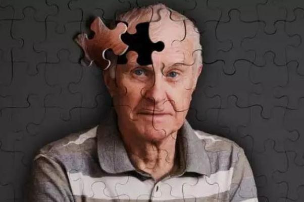 老年癡呆癥怎么治療 老年癡呆癥怎么檢查 老年癡呆癥怎么治療 老年癡呆癥怎么檢查