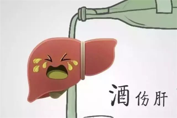 酒精肝會(huì)傳染給別人嗎 酒精肝注意哪些方面 酒精肝會(huì)傳染給別人嗎 酒精肝注意哪些方面
