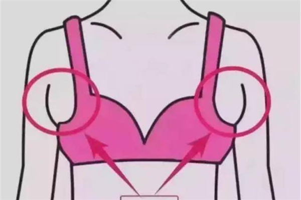 副乳是什么形成的 副乳對身體有什么影響嗎 副乳是什么形成的 副乳對身體有什么影響嗎