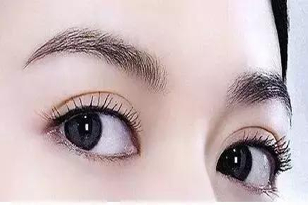 雙眼皮有哪些項(xiàng)目 怎樣選擇適合自己的雙眼皮 雙眼皮有哪些項(xiàng)目 怎樣選擇適合自己的雙眼皮