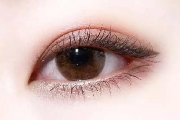 雙眼皮有哪些項(xiàng)目 怎樣選擇適合自己的雙眼皮 雙眼皮有哪些項(xiàng)目 怎樣選擇適合自己的雙眼皮