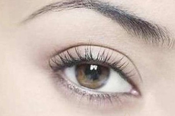 雙眼皮手術(shù)多久能恢復(fù)自然 雙眼皮手術(shù)多少錢一次 雙眼皮手術(shù)多久能恢復(fù)自然 雙眼皮手術(shù)多少錢一次