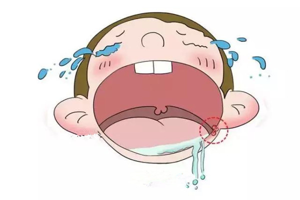 口腔潰瘍怎么治愈 口腔潰瘍怎么緩解疼痛 口腔潰瘍怎么治愈 口腔潰瘍怎么緩解疼痛