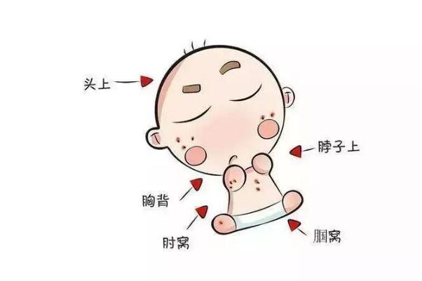 寶寶長痱子要怎么處理 寶寶長痱子要不要穿衣服 寶寶長痱子要怎么處理 寶寶長痱子要不要穿衣服