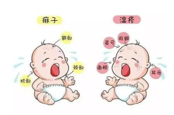 寶寶長痱子要怎么處理 寶寶長痱子要不要穿衣服 寶寶長痱子要怎么處理 寶寶長痱子要不要穿衣服