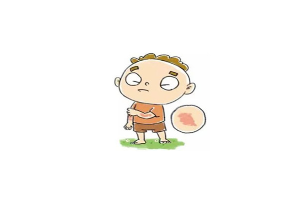 小兒風(fēng)疹是什么癥狀 小兒風(fēng)疹是什么引起的 小兒風(fēng)疹是什么癥狀 小兒風(fēng)疹是什么引起的