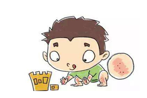 小兒風(fēng)疹怎么止癢 小兒風(fēng)疹怎么護(hù)理 小兒風(fēng)疹怎么止癢 小兒風(fēng)疹怎么護(hù)理