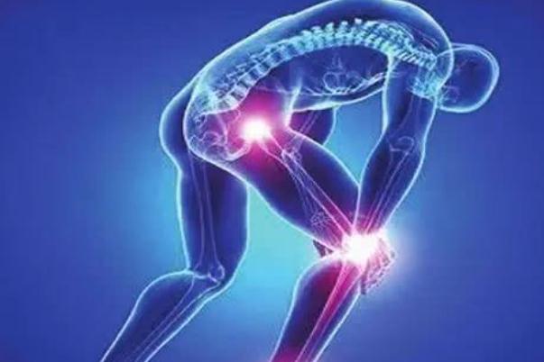 關(guān)節(jié)炎有積液怎么治療 關(guān)節(jié)炎有積液嚴(yán)重嗎 關(guān)節(jié)炎有積液怎么治療 關(guān)節(jié)炎有積液嚴(yán)重嗎