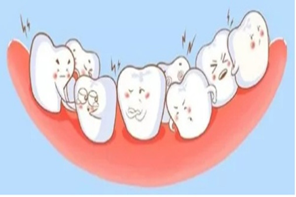 牙齒矯正可以改善臉型嗎 牙齒矯正可以改善下巴后縮嗎 牙齒矯正可以改善臉型嗎 牙齒矯正可以改善下巴后縮嗎