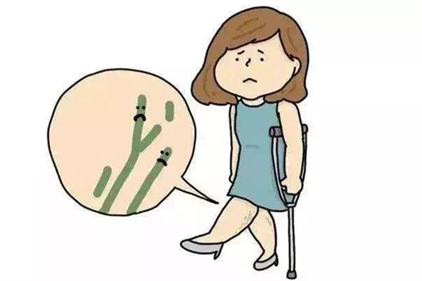 靜脈曲張會死人嗎 靜脈曲張用什么辦法治療最好 靜脈曲張會死人嗎 靜脈曲張用什么辦法治療最好