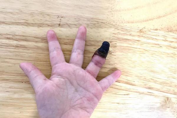 家人錯(cuò)誤包扎致3歲女童手指壞死 傷口如何正確包扎 家人錯(cuò)誤包扎致3歲女童手指壞死 傷口如何正確包扎
