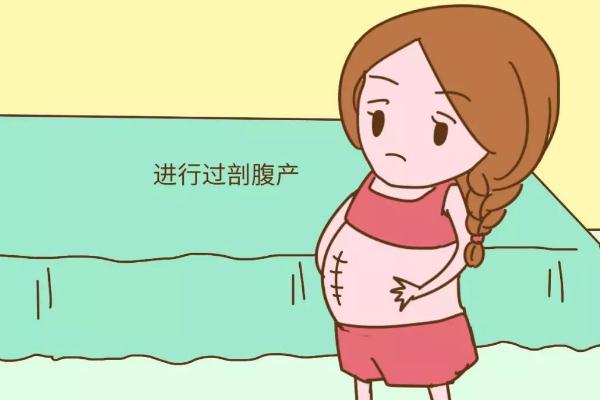 剖腹產(chǎn)的傷疤可以去掉嗎 剖腹產(chǎn)的刀疤一般多久會(huì)徹底恢復(fù) 剖腹產(chǎn)的傷疤可以去掉嗎 剖腹產(chǎn)的刀疤一般多久會(huì)徹底恢復(fù)