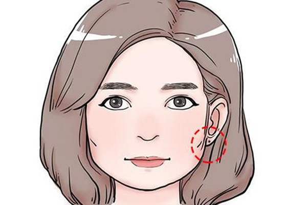 點痣有什么忌口 點痣有什么講究 點痣有什么忌口 點痣有什么講究