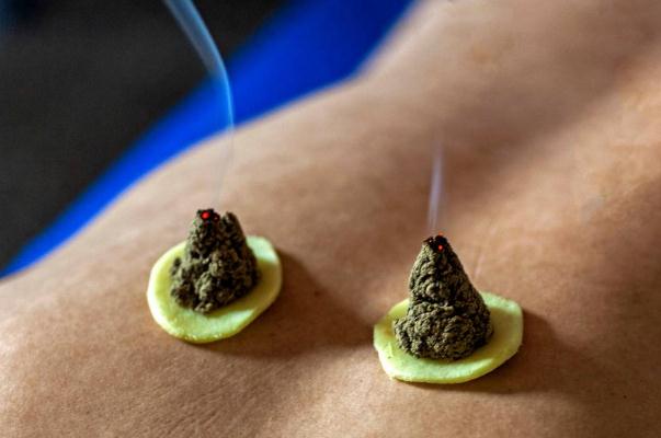 艾灸有減肥的功效嗎 艾灸有消炎的功效嗎 艾灸有減肥的功效嗎 艾灸有消炎的功效嗎