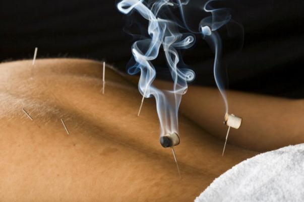 艾灸要隔著衣服嗎 艾灸要注意些什么事項(xiàng) 艾灸要隔著衣服嗎 艾灸要注意些什么事項(xiàng)