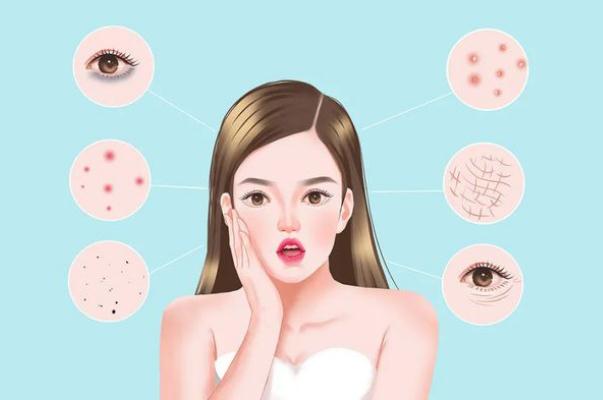 刷酸可以收縮毛孔嗎 刷酸后臉上長了好多小痘痘 刷酸可以收縮毛孔嗎 刷酸后臉上長了好多小痘痘