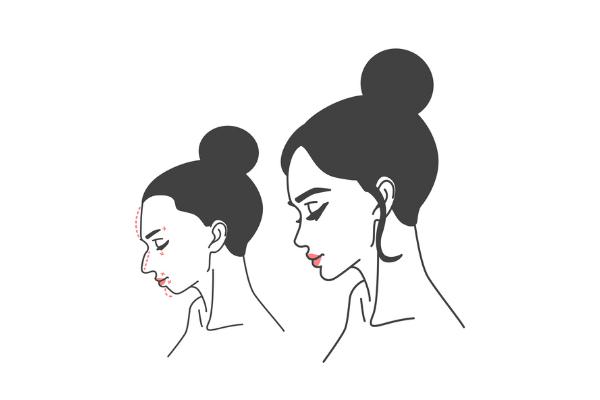 整容有什么后遺癥 整容有風(fēng)險嗎 整容有什么后遺癥 整容有風(fēng)險嗎