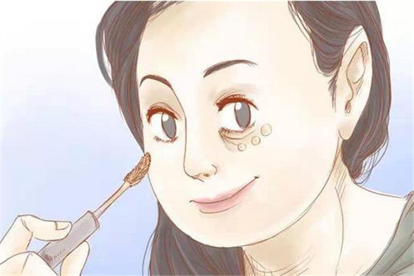 脂肪粒用針挑破可以嗎 脂肪粒用針挑后怎么護(hù)理 脂肪粒用針挑破可以嗎 脂肪粒用針挑后怎么護(hù)理