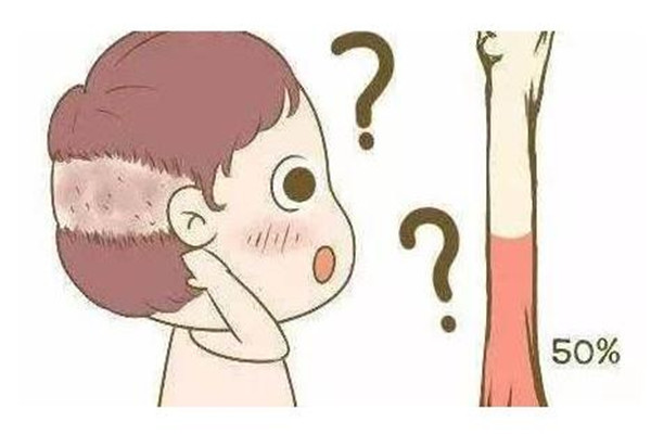 嬰兒枕禿要緊嗎 嬰兒枕禿多久恢復(fù)正常 嬰兒枕禿要緊嗎 嬰兒枕禿多久恢復(fù)正常