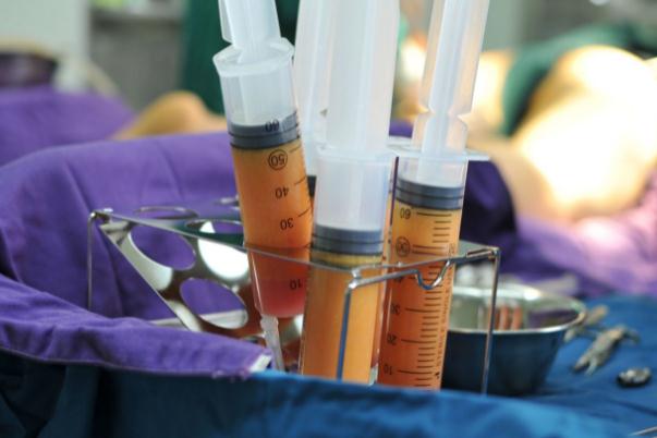 抽脂肪的后遺癥 抽脂肪是怎么抽出來的 抽脂肪的后遺癥 抽脂肪是怎么抽出來的