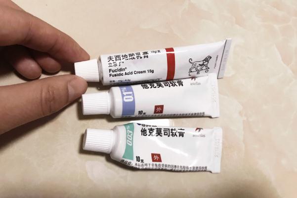 濕疹藥膏是否含激素 不含激素的濕疹藥膏有哪些 濕疹藥膏是否含激素 不含激素的濕疹藥膏有哪些