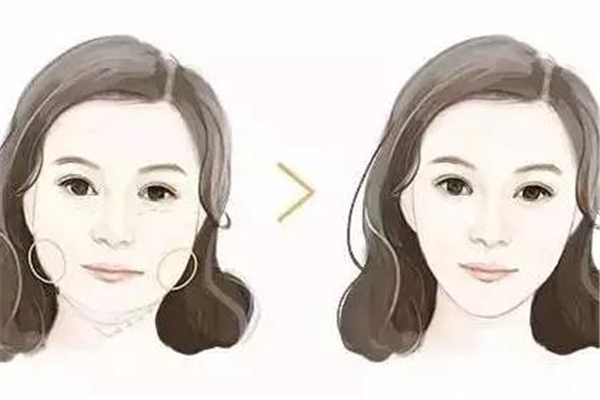 法令紋是不是每個(gè)人都有 有法令紋是不是就老了 法令紋是不是每個(gè)人都有 有法令紋是不是就老了