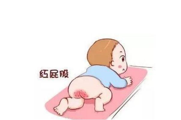 寶寶紅屁股了還能用爽身粉嗎 寶寶紅屁股還能用尿不濕嗎 寶寶紅屁股了還能用爽身粉嗎 寶寶紅屁股還能用尿不濕嗎