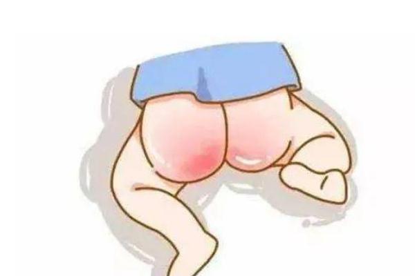 寶寶紅屁股了還能用爽身粉嗎 寶寶紅屁股還能用尿不濕嗎 寶寶紅屁股了還能用爽身粉嗎 寶寶紅屁股還能用尿不濕嗎