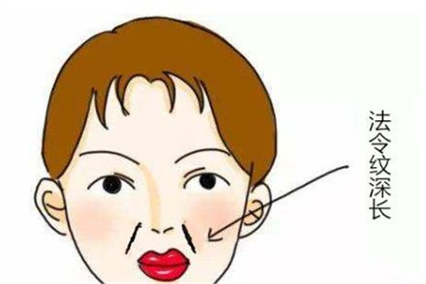 法令紋填充一般需要幾支玻尿酸 法令紋用破尿酸填充維持多久 法令紋填充一般需要幾支玻尿酸 法令紋用破尿酸填充維持多久