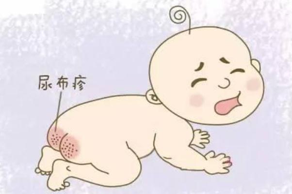 寶寶紅屁股了還能用爽身粉嗎 寶寶紅屁股還能用尿不濕嗎 寶寶紅屁股了還能用爽身粉嗎 寶寶紅屁股還能用尿不濕嗎