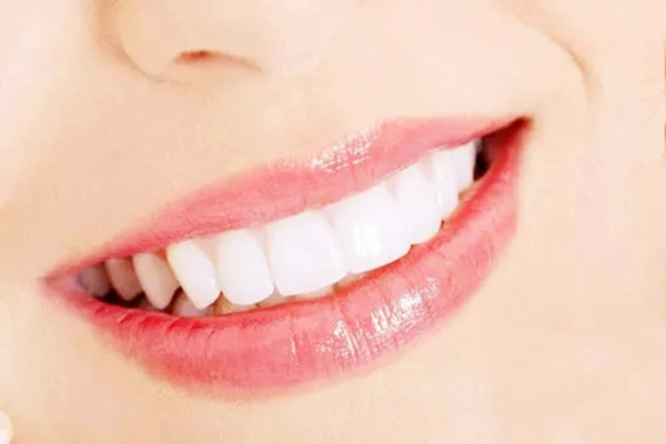 烤瓷牙用什么做的 烤瓷牙用什么材料好 烤瓷牙用什么做的 烤瓷牙用什么材料好